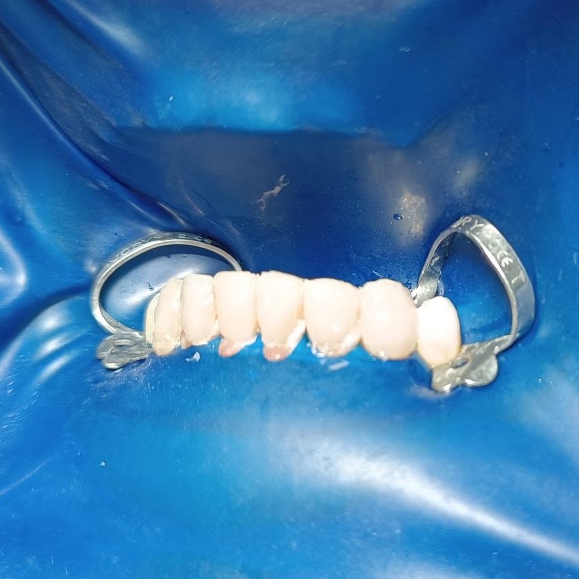 Ricostruzioni Estetiche del Sorriso